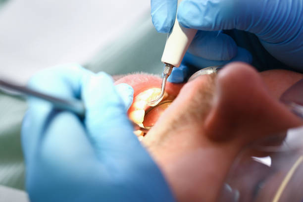 Best Emergency Denture Repair in Carterville, MO